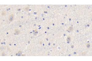 Detection of CYPA in Human Cerebrum Tissue using Polyclonal Antibody to Cyclophilin A (CYPA) (PPIA anticorps  (AA 2-165))