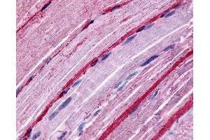Immunohistochemical (Formalin/PFA-fixed paraffin-embedded sections) staining in human myocytes with GRK5 polyclonal antibody . (GRK5 anticorps)