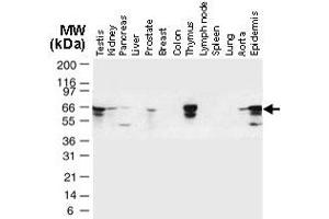Western blot analysis of TRAF6 in normal human tissues. (TRAF6 anticorps)