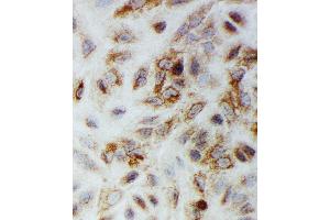 Anti-Smad1 antibody, ICC ICC: A549 Cell
