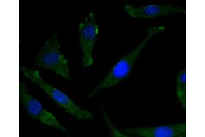 SH-SY-5Y cells were stained with TrkB(Y817) (2A1 ) Monoclonal Antibody  at [1:200] incubated overnight at 4C, followed by secondary antibody incubation, DAPI staining of the nuclei and detection.