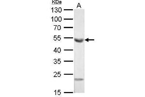WB Image ALDH1A1 antibody [C3], C-term detects ALDH1A1 protein by Western blot analysis. (ALDH1A1 anticorps  (C-Term))