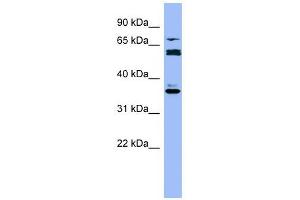 CYP2B6 antibody used at 1 ug/ml to detect target protein. (CYP2B6 anticorps  (Middle Region))