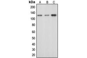 Western blot analysis of c-CBL (pY674) expression in HeLa EGF-treated (A), mouse liver (B), rat liver (C) whole cell lysates. (CBL anticorps  (pTyr674))
