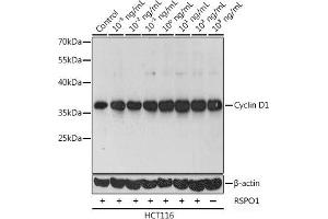Western blot analysis of extracts of HCT116 cells using Cyclin D1 Polyclonal Antibody at dilution of 1:1000. (Cyclin D1 anticorps)