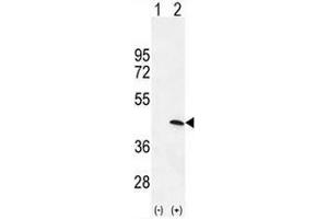 Western blot analysis of PRKAG1 (arrow) using rabbit polyclonal PRKAG1 Antibody (N-term) . (PRKAG1 anticorps  (N-Term))