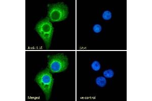 (ABIN570987) Immunofluorescence analysis of paraformaldehyde fixed A431 cells, permeabilized with 0.