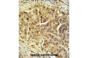 Immunohistochemistry (IHC) image for anti-Cell Division Cycle 45 Homolog (S. Cerevisiae) (CDC45) antibody (ABIN3004359) (CDC45 anticorps)