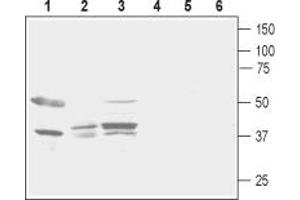 Western blot analysis of rat brain (lanes 1 and 4), rat stomach (lanes 2 and 5) and mouse kidney (lanes 3 and 6) lysates:1-3.