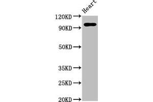 Western Blot Positive WB detected in: Rat heart tissue All lanes: GRM2 antibody at 5 μg/mL Secondary Goat polyclonal to rabbit IgG at 1/50000 dilution Predicted band size: 96 kDa Observed band size: 96 kDa (GRM2 anticorps  (AA 93-221))