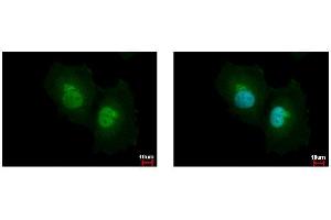 ICC/IF Image ASL antibody detects ASL protein at cytoplasm and nucleus by immunofluorescent analysis. (ASL anticorps)
