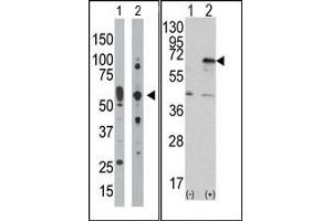 Image no. 1 for anti-Eukaryotic Translation Initiation Factor 2-alpha Kinase 2 (EIF2AK2) (C-Term) antibody (ABIN360664) (EIF2AK2 anticorps  (C-Term))