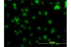 Immunofluorescence of monoclonal antibody to PCNA on HeLa cell. (PCNA anticorps  (AA 1-261))