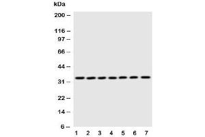 Western blot testing of DCI antibody and Lane 1:  rat liver (DCI anticorps  (C-Term))
