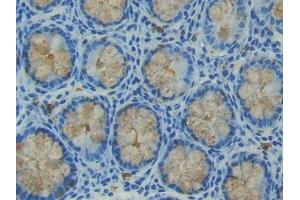 anti-Trefoil Factor 3 (Intestinal) (TFF3) (AA 22-80) antibody