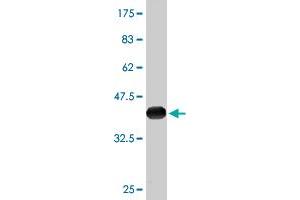 Western Blot detection against Immunogen (36. (NDRG2 anticorps  (AA 1-96))