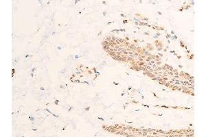 ABIN6267218 at 1/100 staining human skin tissue sections by IHC-P. (SGK1 anticorps  (pSer422))