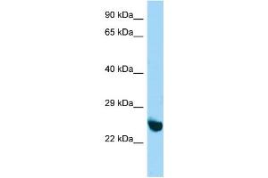 Host:  Rabbit  Target Name:  Unkl  Sample Type:  Mouse Stomach lysates  Antibody Dilution:  1. (UNKL anticorps  (N-Term))