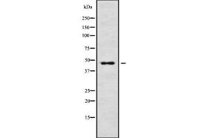 Western blot analysis of ABHD1 using K562 whole cell lysates (ABHD1 anticorps  (Internal Region))
