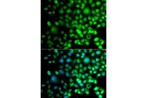 Immunofluorescence analysis of A549 cell using SMAD9 antibody. (SMAD9 anticorps)