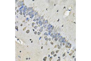 Immunohistochemistry of paraffin-embedded rat brain using MYH1 Antibody (ABIN5974170) at dilution of 1/100 (40x lens). (MYH1 anticorps)