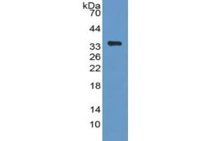Rabbit Capture antibody from the kit in WB with Positive Control: Sample Human Hela cell lysate.