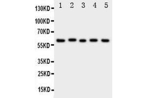 Western blot analysis of ASIC3 using anti- ASIC3 antibody . (ASIC3 anticorps  (N-Term))