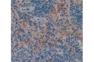 IHC-P analysis of Rat Tissue, with DAB staining. (GZMM anticorps  (AA 19-251))