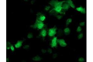 Image no. 3 for anti-Proteasome (Prosome, Macropain) Subunit, beta Type, 4 (PSMB4) antibody (ABIN1500470)