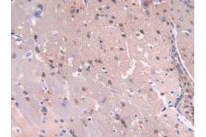 IHC-P analysis of Mouse Brain Tissue, with DAB staining.