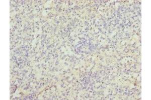 Immunohistochemistry of paraffin-embedded human spleen tissue using ABIN7171726 at dilution of 1:100 (ZBTB48 anticorps  (AA 1-280))