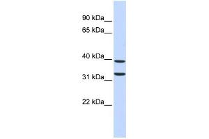 WB Suggested Anti-ZNF177 Antibody Titration:  0. (ZNF177 anticorps  (Middle Region))
