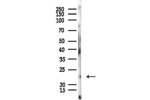 anti-Related RAS Viral (R-Ras) Oncogene Homolog 2 (RRAS2) (C-Term) antibody