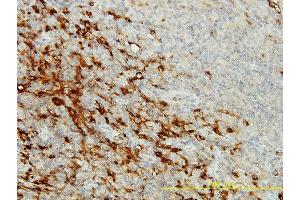 Immunoperoxidase of monoclonal antibody to CPVL on formalin-fixed paraffin-embedded human lymphomar tissue. (CPVL anticorps  (AA 1-476))