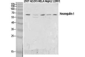 Western Blotting (WB) image for anti-Neuregulin 1 (NRG1) (N-Term) antibody (ABIN3187835) (Neuregulin 1 anticorps  (N-Term))