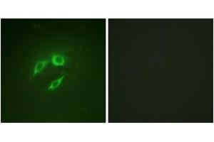 Immunofluorescence analysis of A549 cells, using SEK1/MKK4/JNKK1 (Ab-257) Antibody. (MAP2K4 anticorps  (AA 223-272))