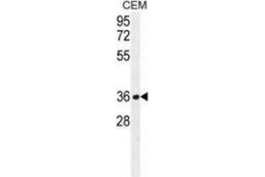 Western blot analysis in CEM cell line lysates (35ug/lane) using NUDT22  Antibody (C-term. (NUDT22 anticorps  (C-Term))