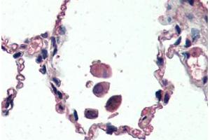 Human Lung (formalin-fixed, paraffin-embedded) stained with UCP2 antibody ABIN461943 at 3. (UCP2 anticorps  (AA 101-113))