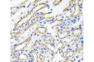 Immunohistochemistry of paraffin-embedded Mouse kidney using IRAK2 Polyclonal Antibody at dilution of 1:100 (40x lens).