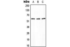 Western blot analysis of PPP2R5A expression in HeLa (A), NIH3T3 (B), H9C2 (C) whole cell lysates. (PPP2R5A anticorps  (Center))
