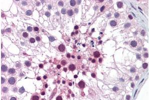 Human Testis: Formalin-Fixed, Paraffin-Embedded (FFPE) (MED26 anticorps  (AA 501-601))