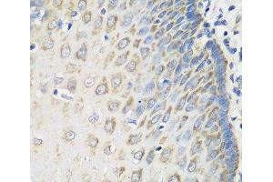 Immunohistochemistry of paraffin-embedded Human esophagus using MSRB2 Polyclonal Antibody at dilution of 1:100 (40x lens).