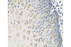 Immunohistochemistry of paraffin-embedded Human esophagus using MSRB2 Polyclonal Antibody at dilution of 1:100 (40x lens). (MSRB2 anticorps)