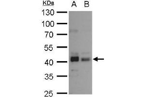 WB Image Bmi1 antibody detects Bmi1 protein by western blot analysis. (BMI1 anticorps  (Center))
