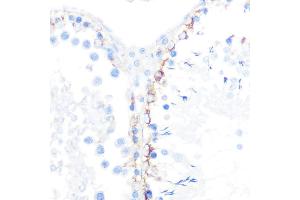 Immunohistochemistry of paraffin-embedded rat testis using γ-Catenin Rabbit mAb (ABIN1683043, ABIN3018625, ABIN3018626 and ABIN7101634) at dilution of 1:100 (40x lens). (JUP anticorps)