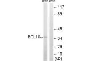 Western blot analysis of extracts from K562 cells, using BCL10 Antibody. (BCL10 anticorps  (AA 111-160))
