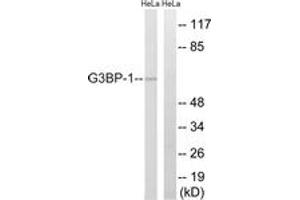 Western blot analysis of extracts from HeLa cells, using G3BP-1 (Ab-232) Antibody. (G3BP1 anticorps  (AA 199-248))