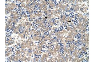 C3ORF10 antibody was used for immunohistochemistry at a concentration of 4-8 ug/ml to stain Hepatocytes (arrows) in Human Liver. (BRK1 anticorps  (Middle Region))