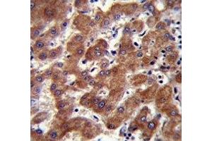 Androgen Receptor antibody (ANDR) immunohistochemistry analysis in formalin fixed and paraffin embedded human liver tissue.
