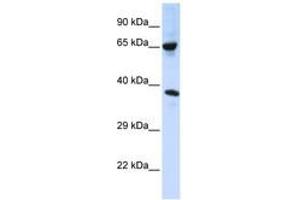 Image no. 1 for anti-Chromosome 6 Open Reading Frame 134 (C6orf134) (AA 108-157) antibody (ABIN6740781) (Chromosome 6 Open Reading Frame 134 (C6orf134) (AA 108-157) anticorps)